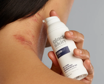 Eczema Moisturizing Cream